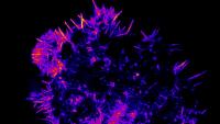 Actin imaged in human natural killer cell activated on glass.
