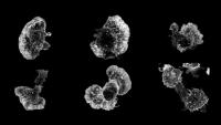 Grayscale microscopy montage of six immune cells with spiky, amoeboid shapes.