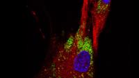 Fluorescence microscopy image of a cell with red cytoplasm, green vesicles, and a blue nucleus.
