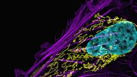 Fluorescence microscopy image of a cell with purple cytoskeleton, yellow mitochondria, and a cyan nucleus.